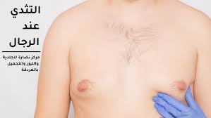 Image result for Gynecomastia