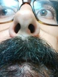 Most cases are easy to treat, but more severe infections may require additional treatment to avoid complications. Noticed This Lump Forming In My Nostril Nasal Vestibulitis Popping