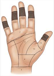 The most inaccurate test was the standard test. 3 Flexor Tendon Repair Zone 1 Plastic Surgery Key