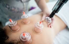 Acupuncture Qualifications: Your Guide to a Rewarding Career - American  Institute of Alternative Medicine