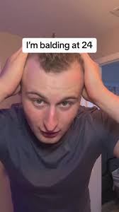 Please stop mentioning my hairline 😭 I get it #balding #maryruths  #maryruths #multivitamin #hairgrowth #hair