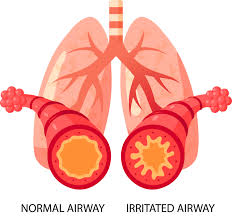 Asthma : Symptoms, Treatment & Causes - Dr Chhabra