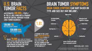 Although they are most common among older adults, they can develop at any age. Navigating Brain Cancer With Information Inspiration And Informatics Brainlab