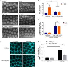 This location serves 18,332 newtown square residents with a median income of $100,539. Olfactory Learning Primes The Heat Shock Transcription Factor Hsf 1 To Enhance The Expression Of Molecular Chaperone Genes In C Elegans Biorxiv