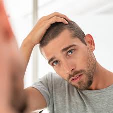 If it does, people will not take it for hair loss. Hair Loss Treatments Explained Minoxidil Finasteride Biotin Dht Blocking Man For Himself