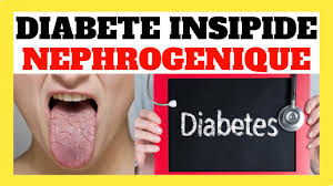 Résultat, au lieu du litre habituel, on urine chaque jour des litres d'urines diluées. Diabete Insipide Nephrogenique Symptomes Et Traitements Youtube