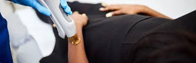 Book a consultation to learn more Laser Hair Removal For Dark Skin Sk N Clinics