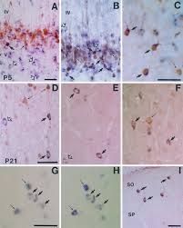37 full pdfs related to this paper. Regional And Cellular Patterns Of Reelin Mrna Expression In The Forebrain Of The Developing And Adult Mouse Journal Of Neuroscience