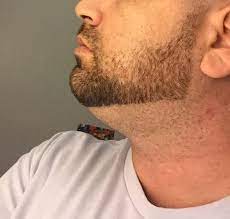 Pin By Michael On Beard Styles For Men In 2021 Guys Grooming Hipster Beard Chin Beard