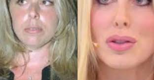 | pagina 8 di 18 Loredana Lecciso Ecco Com Era Da Giovane E Come E Cambiata Oggi Tuttouomini