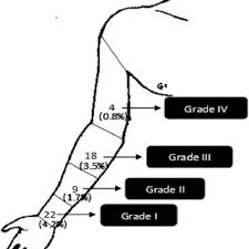 It will generate a textual output indicating which elements are in each intersection. Easy Early Discharge After Transradial Stenting Of Coronary Arteries Download Scientific Diagram