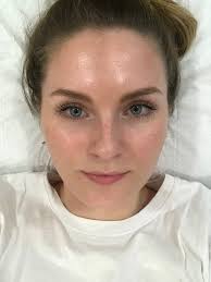 Take warm — not hot — baths and showers. How To Treat Broken Capillaries On The Face Popsugar Beauty