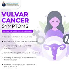 Image result for Vulvar Cancer