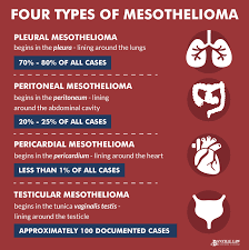 Four primary mesothelioma types by location. Mesothelioma Lawsuits Seeking Compensation After Asbestos Exposure