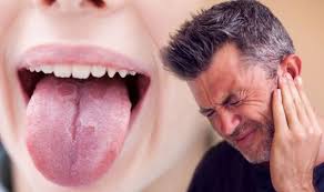 In the early stages, mouth cancer rarely causes any pain. Tongue Cancer Ear Pain Is A Lesser Known Warning Sign Signalling The Disease Express Co Uk