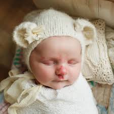 Hello, My names Angel. I am the very proud mummy to my beautiful daughter  Brooklyn, she was born with a Symbrachydactyly hand difference, which is a  underdevelopment of the hand. Also born