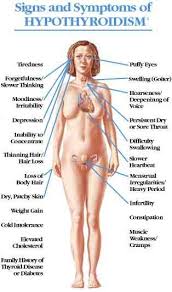 Papillary cancer, also known as papillary carcinomas or papillary adenocarcinomas, comprise about 80% of all thyroid cancers. 150 Thyroid Ideas Thyroid Thyroid Health Hypothyroidism