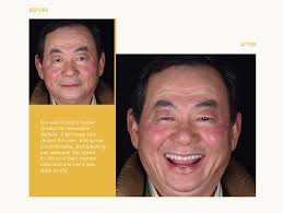 How to choose your All-on-4 clinic: 7 things to consider