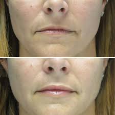 José Raúl Montes Eyes & Facial Rejuvenation