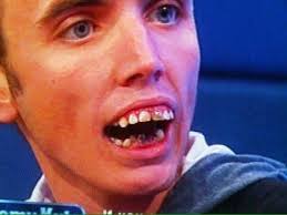 People in britain can now repair their own teeth. Jeremy Kyle Show Seven Sets Of Teeth Most Slated By Viewers Revealed Mirror Online