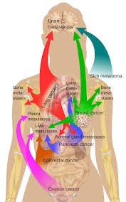 Pin On Health And Nutrition