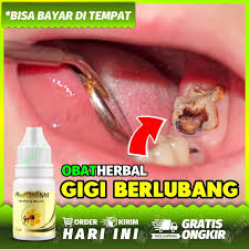 Sakit gigi geraham yang merupakan salah satu dari jenis jenis penyakit gigi yang terjadi termasuk gejala nyeri gigi geraham sendiri tergantung dari penyebabnya, namun beberapa gejala umum yang. Obat Sakit Gigi Berlubang Nyeri Gigi Gusi Bengkak Sakit Gigi Geraham Gusi Gigi Geraham Bengkak Gigi Bolong Polip Gigi Bukan Obat Sakit Gigi Cap Burung Kakak Tua Lazada Indonesia