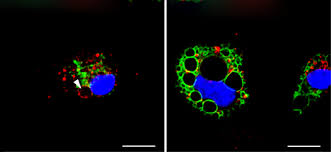 Check spelling or type a new query. Probing The Pores In Membrane Vesicles