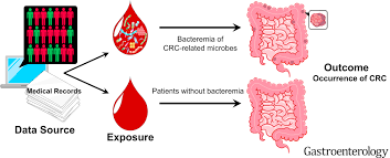 This factsheet is about bowel (colon) cancer. Association Between Bacteremia From Specific Microbes And Subsequent Diagnosis Of Colorectal Cancer Gastroenterology