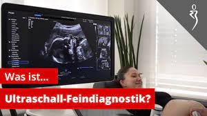 Ab wann ist diese feindiagnostik eigentlich möglich? Pranatale Diagnostik Was Ist Ultraschall Feindiagnostik Youtube