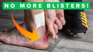 How To Never Get Blisters Again Top 5 Blister Hacks Youtube