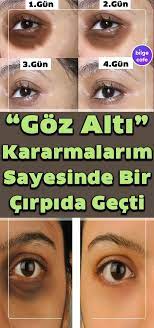 Goz Alti Kararmalarini Geciriyor Alti Geciriyor Goz Kararmalarini Dogal Cilt Bakimi Cilt Urunleri Dogal Cilt