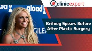 According to rolling stone, britney's mother allowed her daughter to undergo breast augmentation surgery when she was only a teenager. Britney Spears Before After Plastic Surgery Clinicexpert
