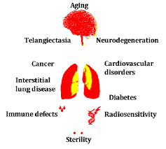 Image result for Ataxia