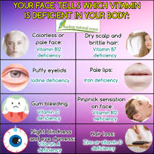 Vitamin b12 deficiency, also known as cobalamin deficiency, is the medical condition of low blood and tissue levels of vitamin b12. B12 Deficiency Symptoms Hair Loss