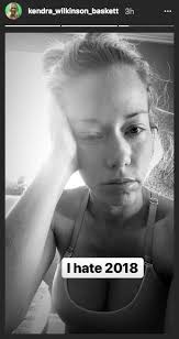 Kendra Wilkinson's dog dies two weeks after she announces her divorce