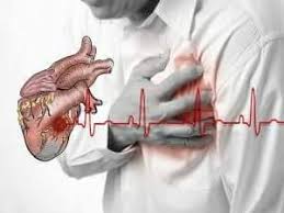 Image result for Njia za kuzuia shambulizi la moyo