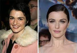 Of course, it's up to them to. Rachel Weisz Plastic Surgery Before And After The Procedure And Process Celebrity Plastic Surgery Nose Job Plastic Surgery