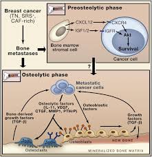 The risks of breast cancer recurrence. Breast Cancer Bone Metastases It S All About The Neighborhood Cell
