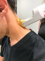 The extra strength depilatory cream is formulated specially for coarse male body hair and is effective in as little as 4 minutes. Laser Hair Removal For Men Bella Luce Med Spa