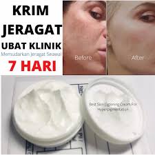 Lepas ni tak payah pening dah le'glowry kan ada! Buy Krim Jeragat Ubat Klinik Seetracker Malaysia