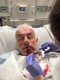 HOP riders sharing a note from Dan Shore's girlfriend: “Dan Shore was hit  by a car and suffered major injuries including a broken back, broken ankle,  broken clavicle, fractured ribs and a