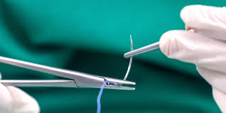 Image result for Suture Material