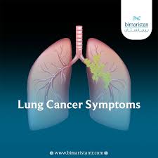 Image result for Lung Cancer