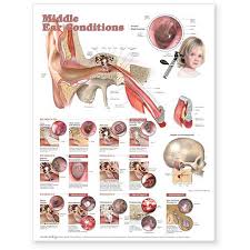 middle ear conditions unmounted chart middle ear conditions