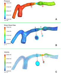 A member of the governing people's action party (pap), he was appointed the minister for national development after the 2015 general election. Evaluation Of Computational Fluid Dynamics Model Of An Atherosclerotic Download Scientific Diagram