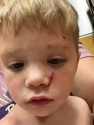 What is the most humane way to cull roosters?