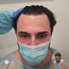 @KSL_Clinics's video Tweet