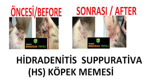 Hidradenitis Suppurativa Hs Kopek Memesi Hastaligi Bitkisel Tedavisi Oncesi Before Sonrasi After Youtube