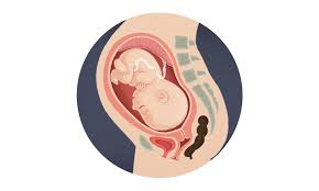 Fetal Position During Pregnancy Doctors Australia