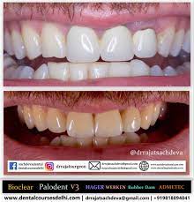 One month course 8 days. Cosmetic Dentistry Training Dental Courses Delhi